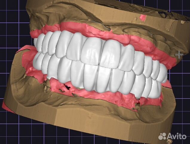 Зубной техник cad Cam