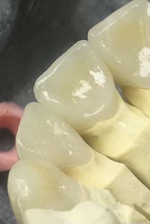 Зубной техник